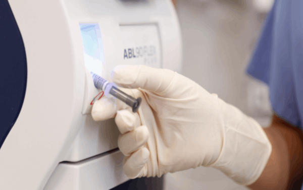 ¿Qué es la gasometría arterial?