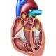 ¿Qué es la insuficiencia de la válvula pulmonar?