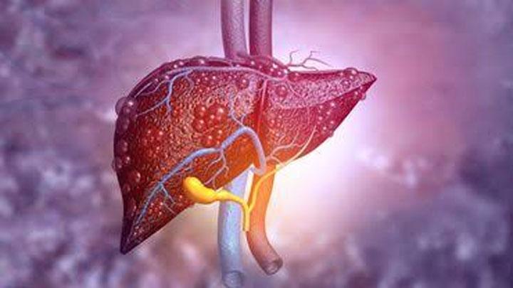 ¿Qué es la hepatitis autoinmunitaria?