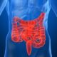 Factores genéticos y ambientales causantes de enfermedad de Crohn