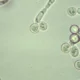 Infecciones mucocutáneas frecuentes causadas por Candida en pacientes con diabetes mellitus.