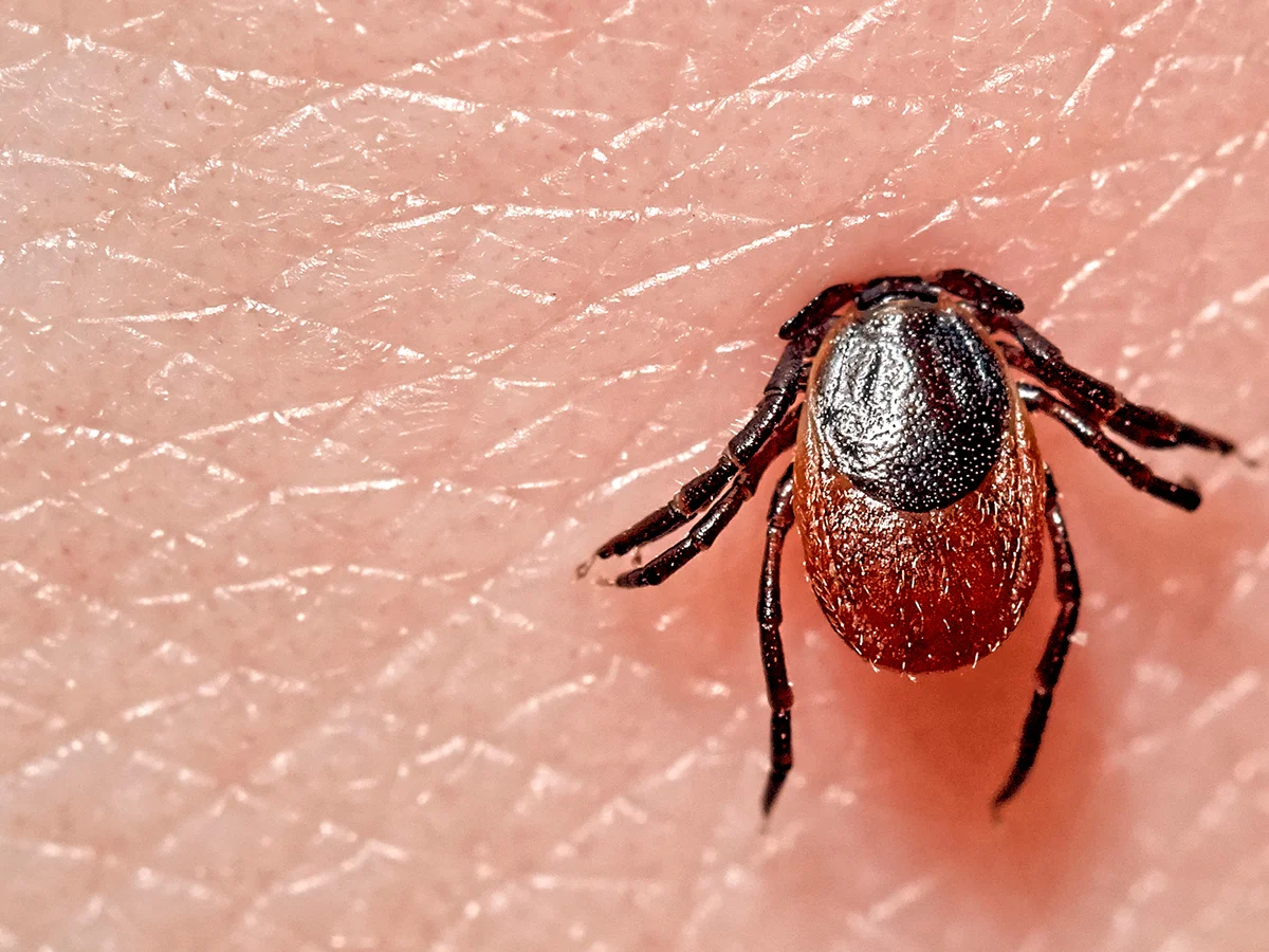 Fiebre por garrapatas del Colorado
