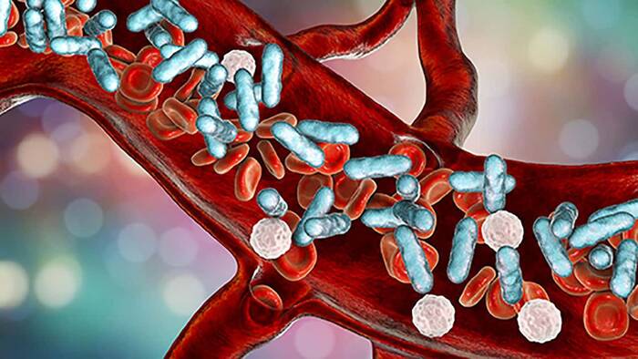 20 Conceptos sobre choque septicémico que debes saber.