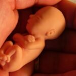Aborto. Repaso rápido de conceptos