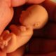 Aborto. Repaso rápido de conceptos