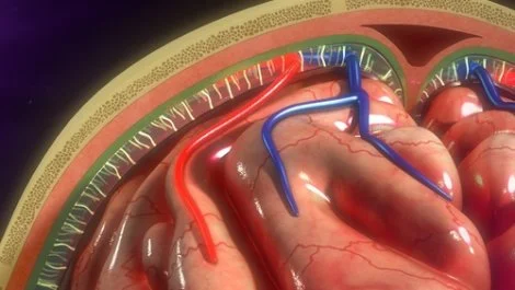 ¿Cuáles son las causas frecuentes de meningitis bacteriana?