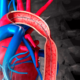 Repaso rápido: Coartación de la aorta