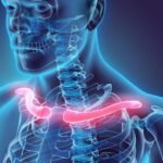 ¿Cómo se clasifican las fracturas de clavícula?