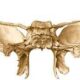 Huesos del cráneo: esfenoides
