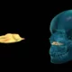 Huesos del macizo facial: cornete nasal inferior