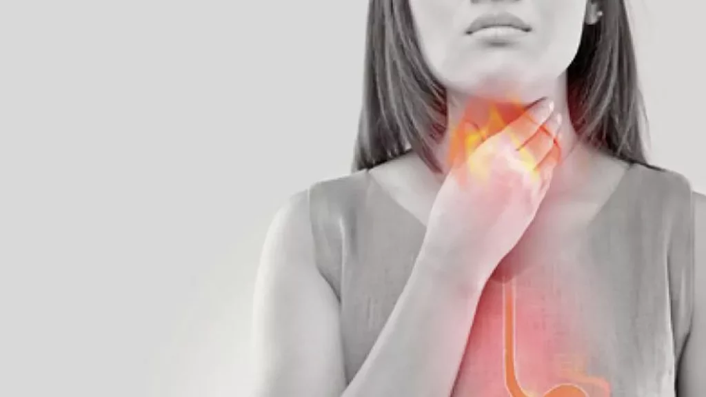 ¿Qué es la enfermedad por reflujo gastroesofágico?