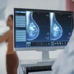 ¿Qué es BI-RADS, el Sistema de datos e informes de imágenes de mama?