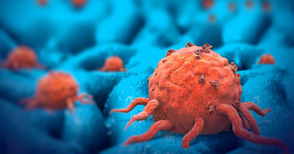 ¿Qué es una neoplasia? tumores malignos y benignos
