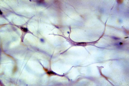 ¿Qué células hay en la dermis?