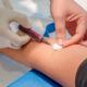 ¿Cómo se realiza el diagnóstico de diabetes mellitus?