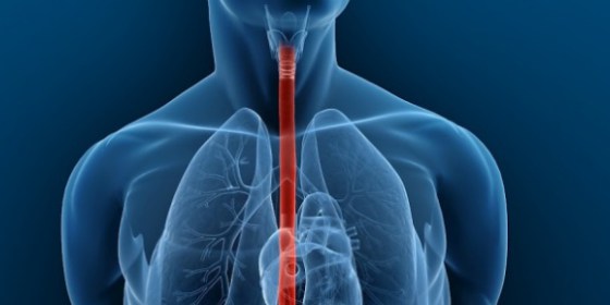 síndrome de Plummer-Vinson o Patterson-Brown-Kelly