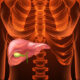 ¿Qué es la colangitis aguda?