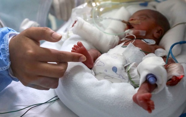 Diferencia entre sepsis precoz y tardía en el recién nacido.