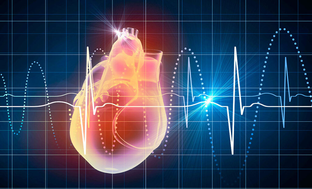 Utilidad del EKG y limitaciones