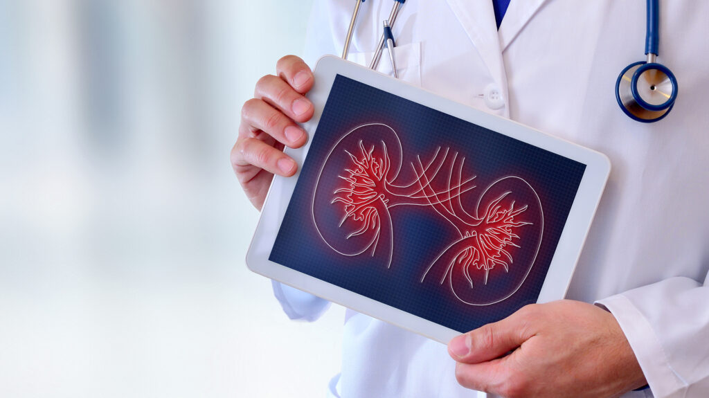Relación entre la enfermedad renal y VIH