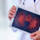 Relación entre la enfermedad renal y VIH
