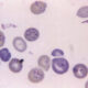 ¿Qué es la babesiosis?