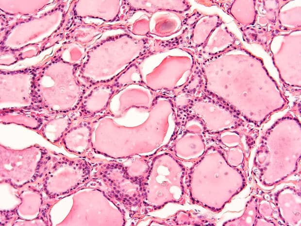 ¿Qué es un folículo tiroideo?