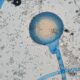 ¿Qué es la mucormicosis?