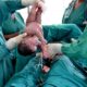 Dosis de oxitocina para prevenir atonía uterina post cesárea