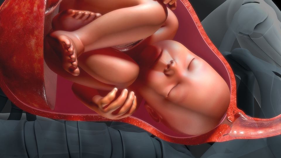 ¿Cuáles son las causas de distocia de parto?