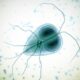 ¿Qué es la giardiosis?