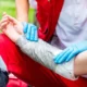 Primeros auxilios en pacientes quemados