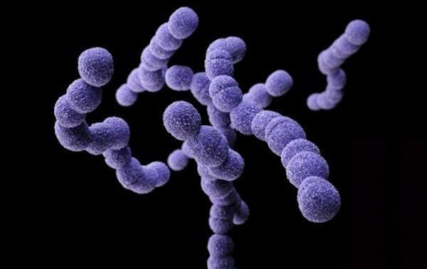 ¿Qué causa la infección por estreptococos del grupo B?