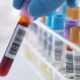 ¿Cuáles son las pruebas de laboratorio útiles en el diagnóstico de enfermedades de la vía biliar?