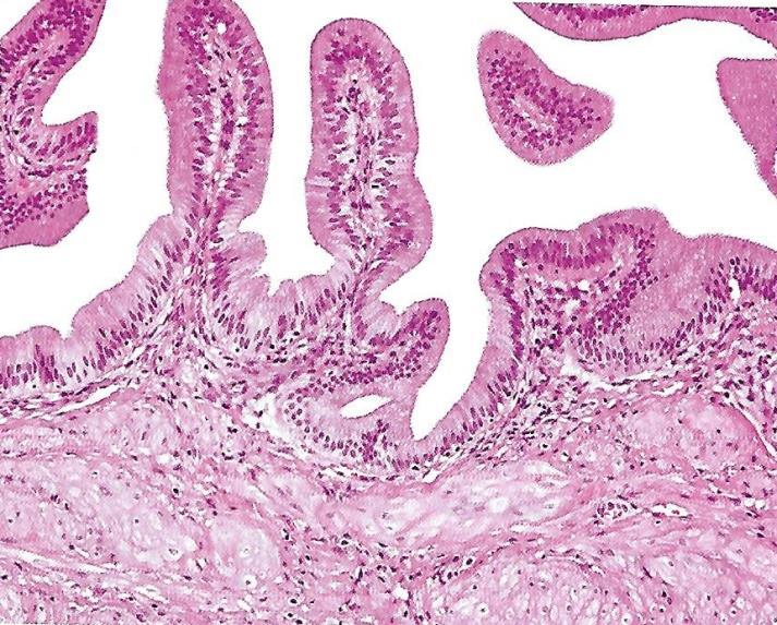 Anatomía microscópica de la vesícula biliar