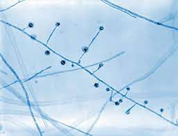 ¿Qué causa la blastomicosis?
