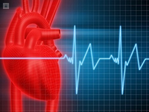 Clasificación de las arritmias cardiacas