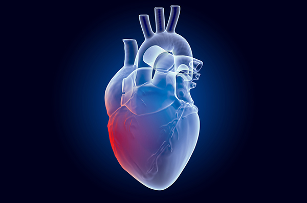 ¿Cómo se clasifican las miocardiopatías?