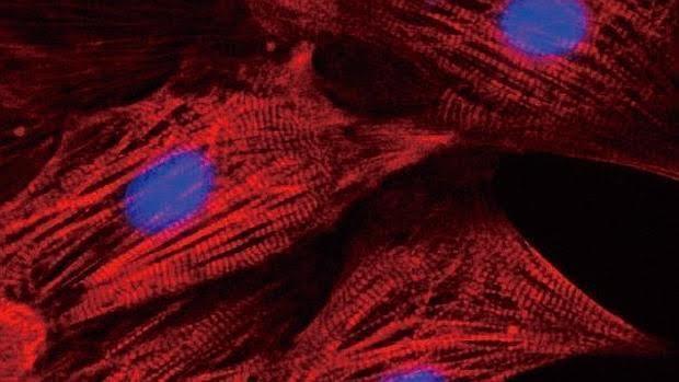 ¿Cuáles son los tipos de células cardiacas?