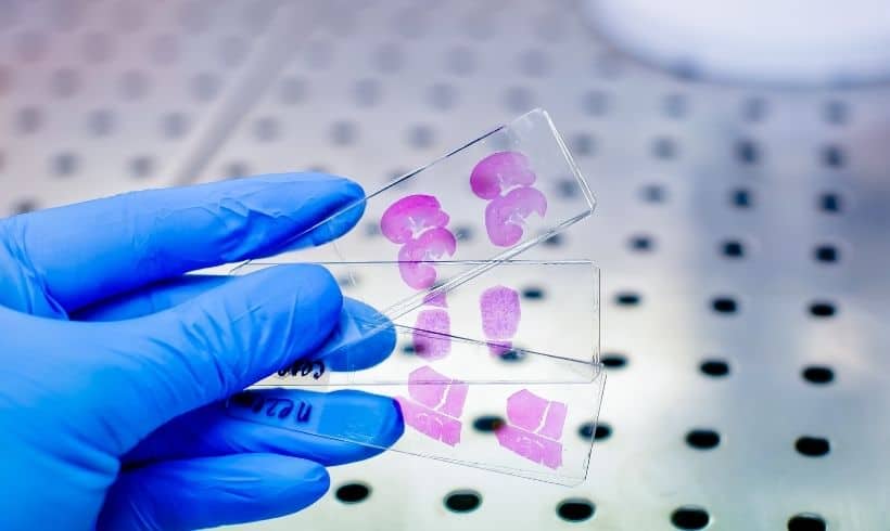 Técnica de tinción con hematoxilina & eosina