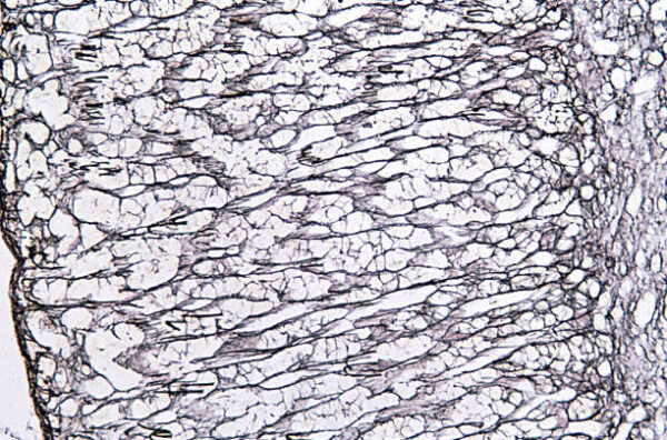 ¿Qué son las fibras reticulares del tejido conjuntivo?