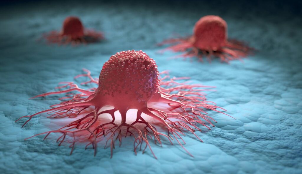 ¿Cómo se produce el cáncer?