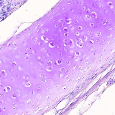 ¿Qué es el tejido cartilaginoso?