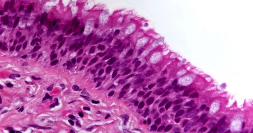 ¿Qué es el epitelio?