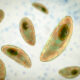 Toxoplasmosis