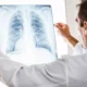 ¿Cómo surge la disnea?