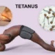 Toxina tetánica