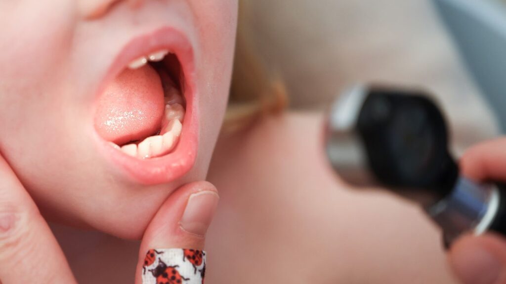 ¿Cuáles son los factores de riesgo para fiebre reumática?