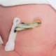 ¿Qué es el cordón umbilical?