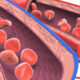 ¿Qué es la distensibilidad vascular?